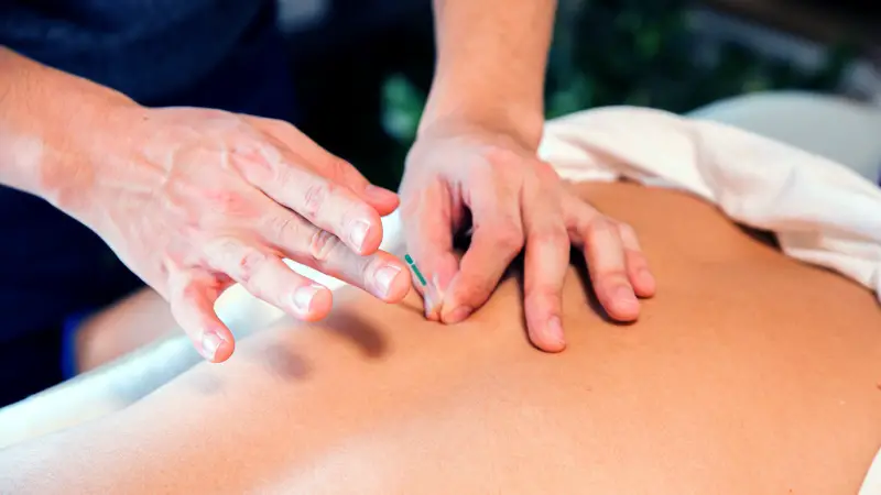 acupuncture needle being placed into someone's back.