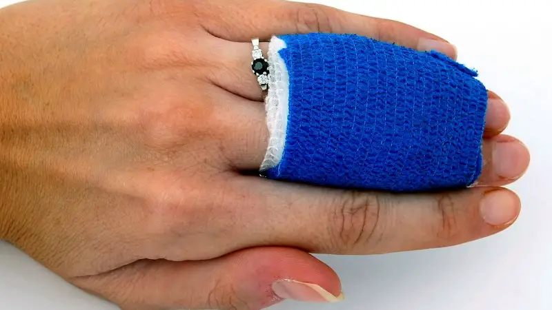 A woman's hand with her two middle fingers bandaged up in gauze.