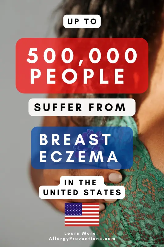 breast eczema infographic fact. Up to 500,000 people suffer from breast eczema in the United States. Created by AllergyPreventions