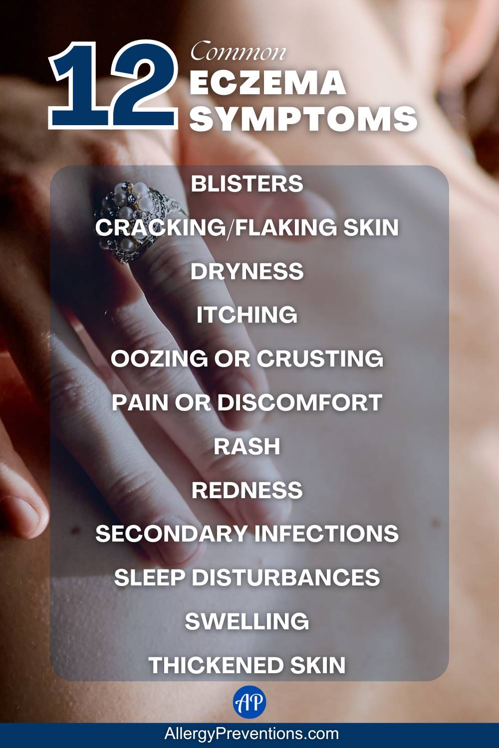 common eczema symptoms infographic. Here is a list of the 12 most common symptoms you may experience with eczema: Blisters Cracking/flaking skin, dryness, itching, oozing or crusting, pain or discomfort, rash, redness, secondary infections, sleep disturbances, swelling, and thickened skin.