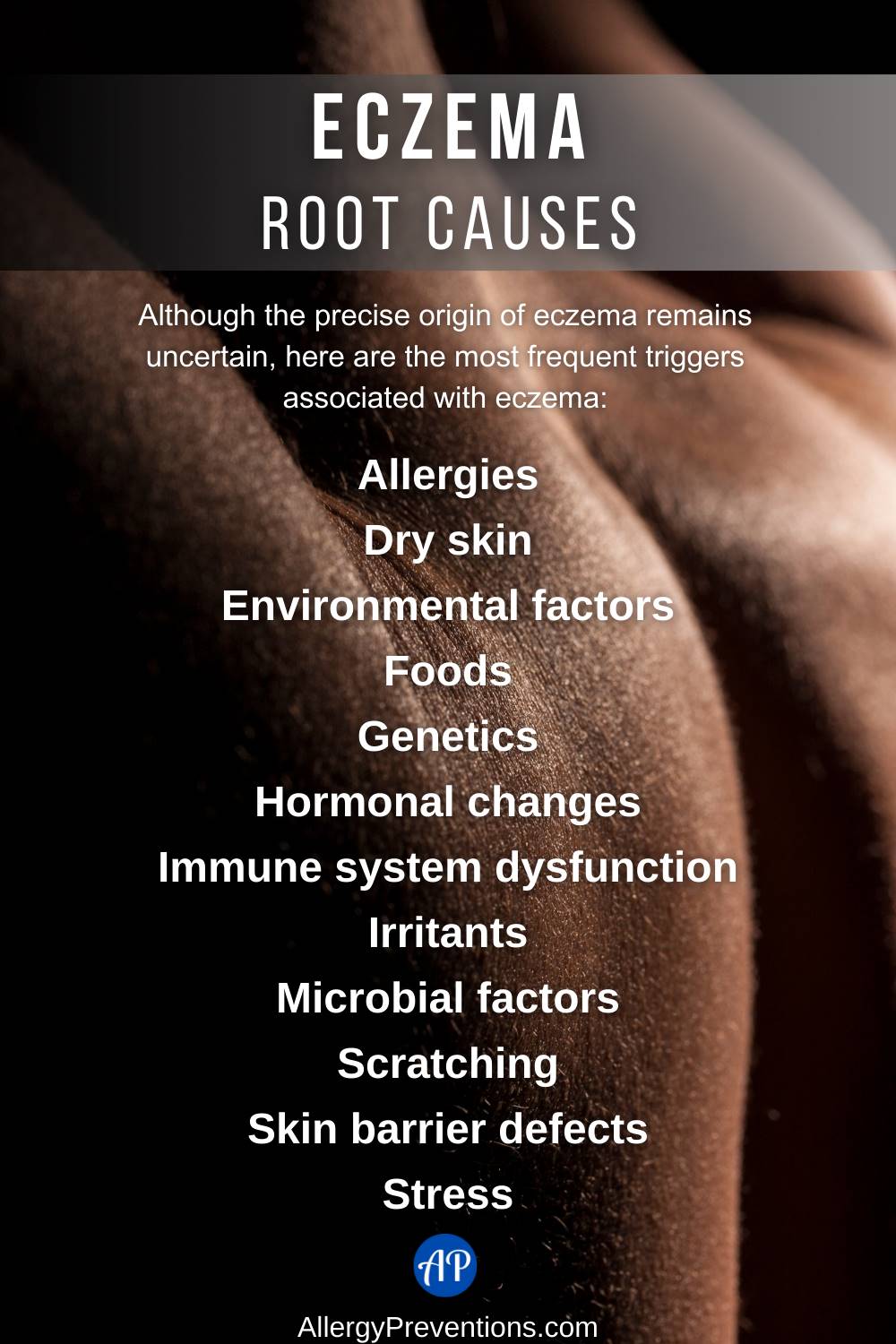 Eczema root causes infographic. Although the precise origin of eczema remains uncertain, here are the most frequent triggers associated with eczema: Allergies, Dry skin, Environmental factors, Foods, Genetics, Hormonal changes, Immune system dysfunction, Irritants, Microbial factors, Scratching, Skin barrier defects, and Stress.