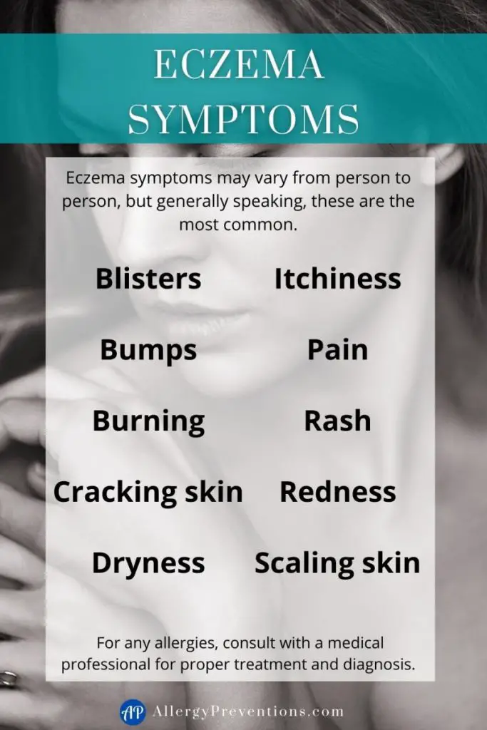 Eczema symptoms infographic. Eczema symptoms may vary from person to person, but generally speaking, these are the most common. Blisters, Bumps, Burning, Cracking skin, Dryness Itchiness, Pain, Rash, Redness, Scaling skin. For any allergies, consult with a medical professional for proper treatment and diagnosis.