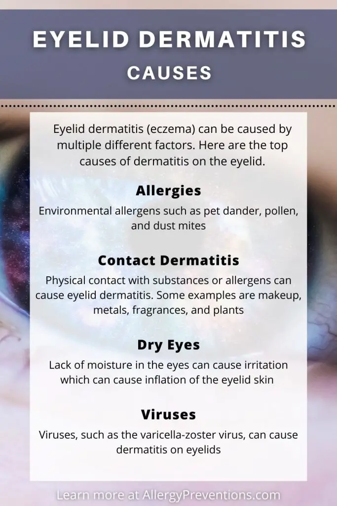 eyelid dermatitis causes infographic. Eyelid dermatitis (eczema) can be caused by multiple different factors. Here are the top causes of dermatitis on the eyelid. Allergies: Environmental allergens such as pet dander, pollen, and dust mites. Contact Dermatitis: Physical contact with substances or allergens can cause eyelid dermatitis. Some examples are makeup, metals, fragrances, and plants. Dry Eyes: Lack of moisture in the eyes can cause irritation which can cause inflation of the eyelid skin. Viruses: Viruses, such as the varicella-zoster virus, can cause dermatitis on eyelids.
