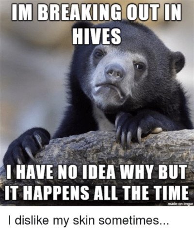 a hives meme of a bear with a sad face, on a log, with the caption: I am breaking out in hives, I have no idea why, but it happens all the time 