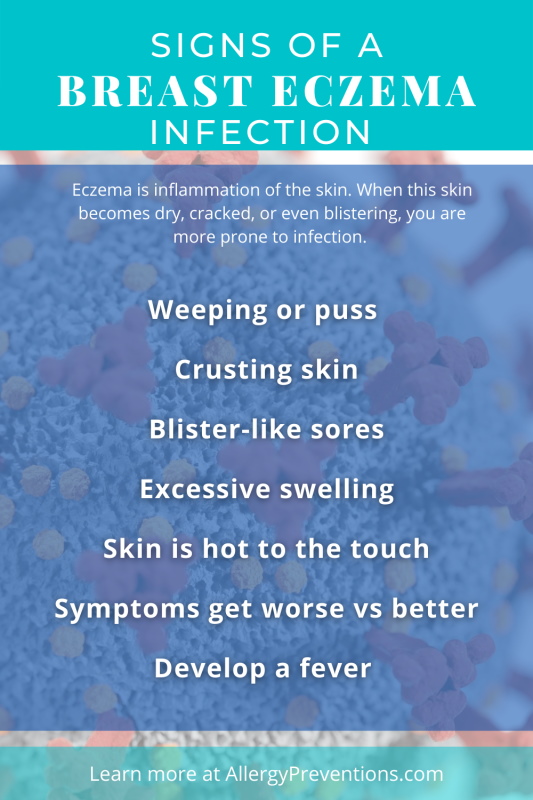 Signs of a breast eczema infection. Eczema is inflammation of the skin. When this skin becomes dry, cracked, or even blistering, you are more prone to infection. Weeping or puss, Crusting skin, Blister-like sores, Excessive swelling, Skin is hot to the touch, Symptoms get worse vs better, Develop a fever. created by allergypreventions