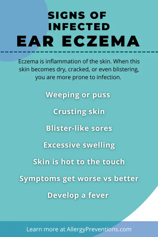 Signs of infected ear eczema infographic. Eczema is inflammation of the skin. When this skin becomes dry, cracked, or even blistering, you are more prone to infection. Weeping or puss , Crusting skin, Blister-like sores, Excessive swelling, Skin is hot to the touch, Symptoms get worse vs better, Develop a fever. visual created by allergypreventions  