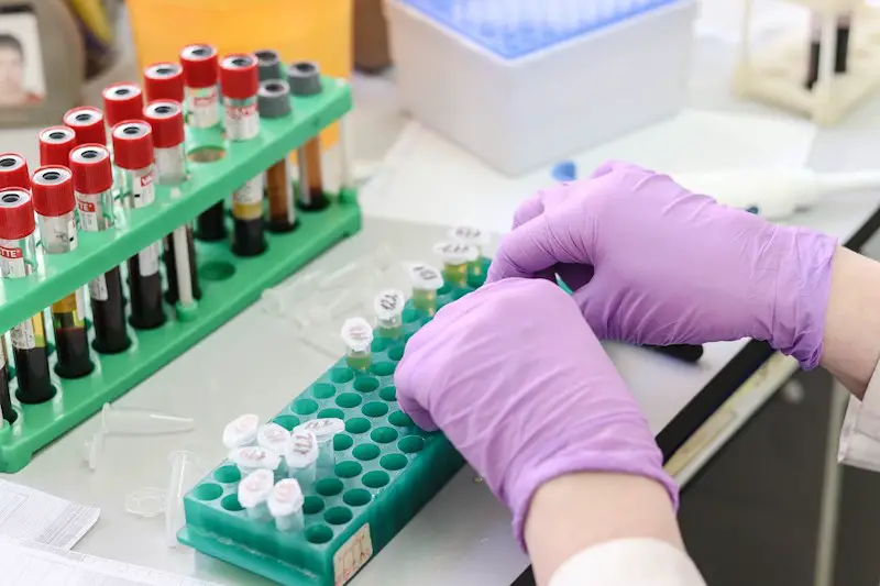 A lab technician sorting through different lab tests for analysis.
