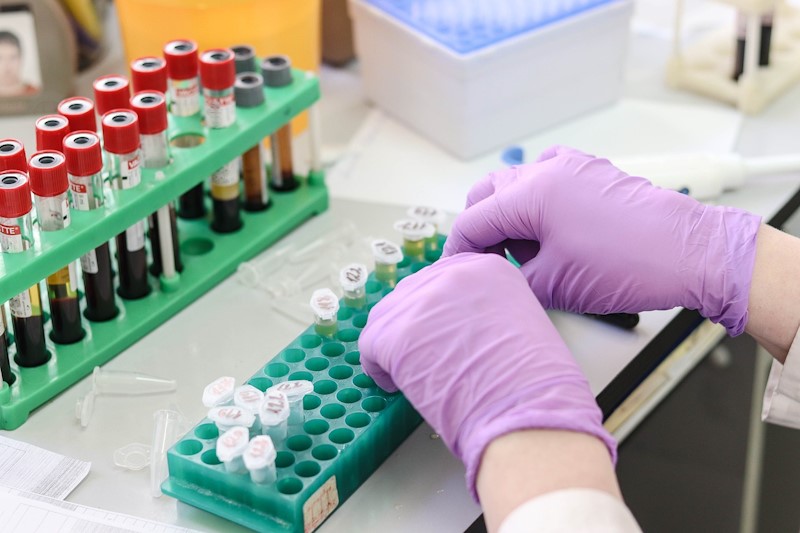 A lab technician sorting through different lab tests for analysis.