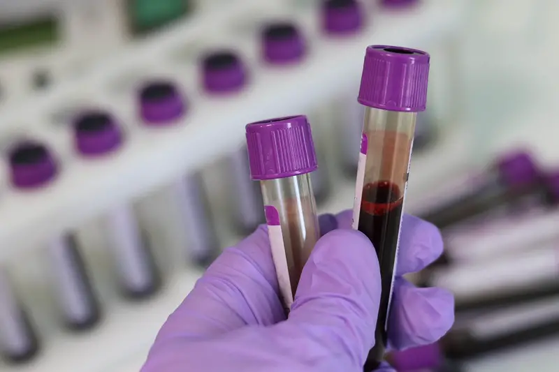 A lab technician holding two vials of blood for testing