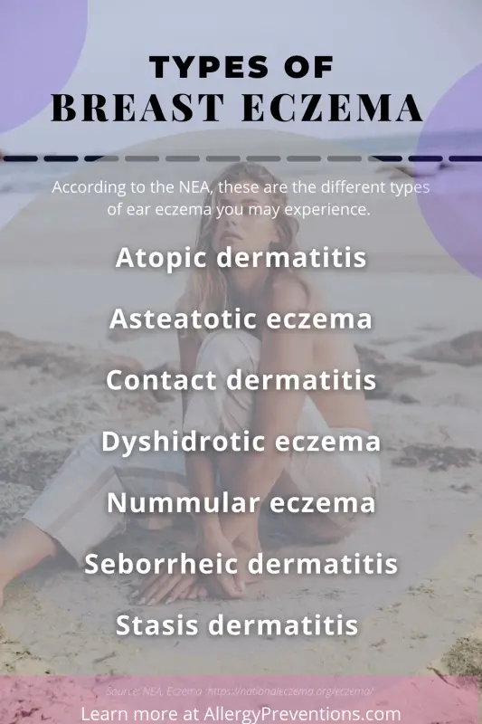 types of breast eczema infographic.  According to the NEA, these are the different types of ear eczema you may experience. Atopic dermatitis, Asteatotic eczema, Contact dermatitis
Dyshidrotic eczema, Nummular eczema
Seborrheic dermatitis, Stasis dermatitis. Created by allergypreventions