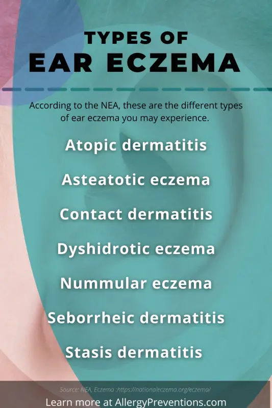 seven types of ear eczema infographic. According to the NEA, these are the different types of ear eczema you may experience.  Atopic dermatitis Asteatotic eczema, Contact dermatitis, Dyshidrotic eczema, Nummular eczema, Seborrheic dermatitis, Stasis dermatitis
visual by allergypreventions