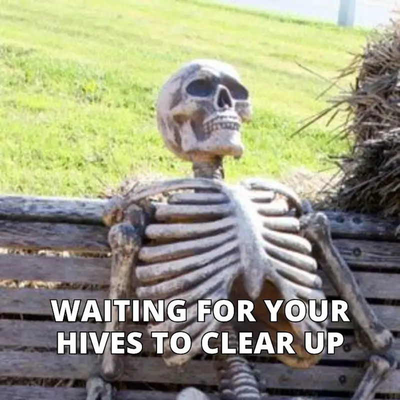 Skeleton waiting meme of a skeleton sitting on a bench. Waiting for your hives to clear up.