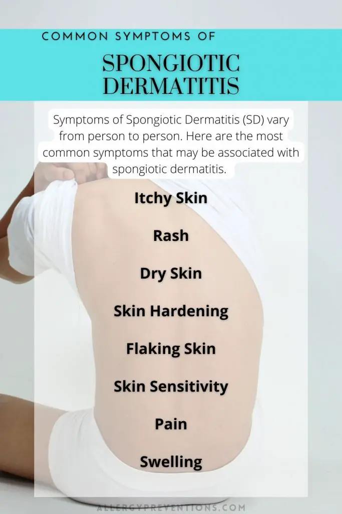 Common symptoms of Spongiotic Dermatitis infographic. Man holding up the back of his shirt with the following information.  Symptoms of Spongiotic Dermatitis (SD) vary from person to person. Here are the most common symptoms that may be associated with spongiotic dermatitis. Itchy Skin
Rash
Dry Skin
Skin Hardening
Flaking Skin
Skin Sensitivity
Pain
Swelling