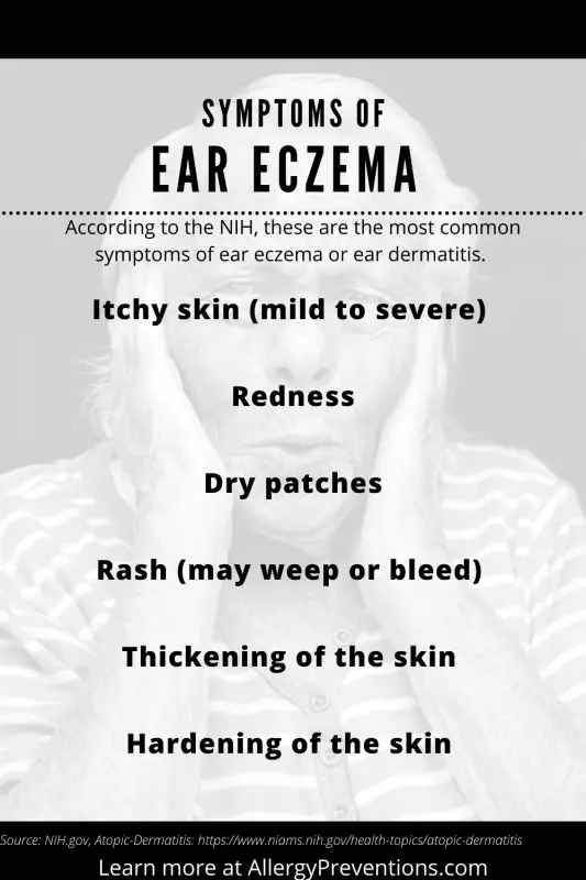 Symptoms of ear eczema infographic. Background image of an elderly man holding his ears. According to the NIH, these are the most common symptoms of ear eczema or ear dermatitis. Itchy skin (mild to severe), Redness, Dry patches, Rash (may weep or bleed), Thickening of the skin , Hardening of the skin. Design by allergypreventions