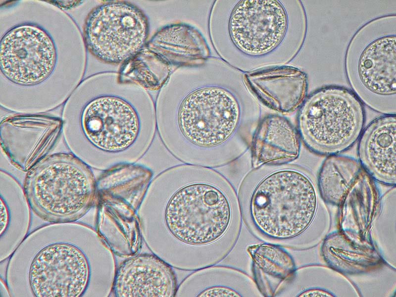 Microscopic image of what juniper pollen looks like. Juniper pollen is small, round, and has a thin outer wall, and a thick inner wall.