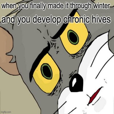 Tom the cat wide eyes meme. Caption: When you finally made it through winter and you develop chronic hives. 