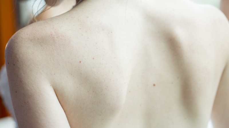 a woman's upper back without a shirt on.