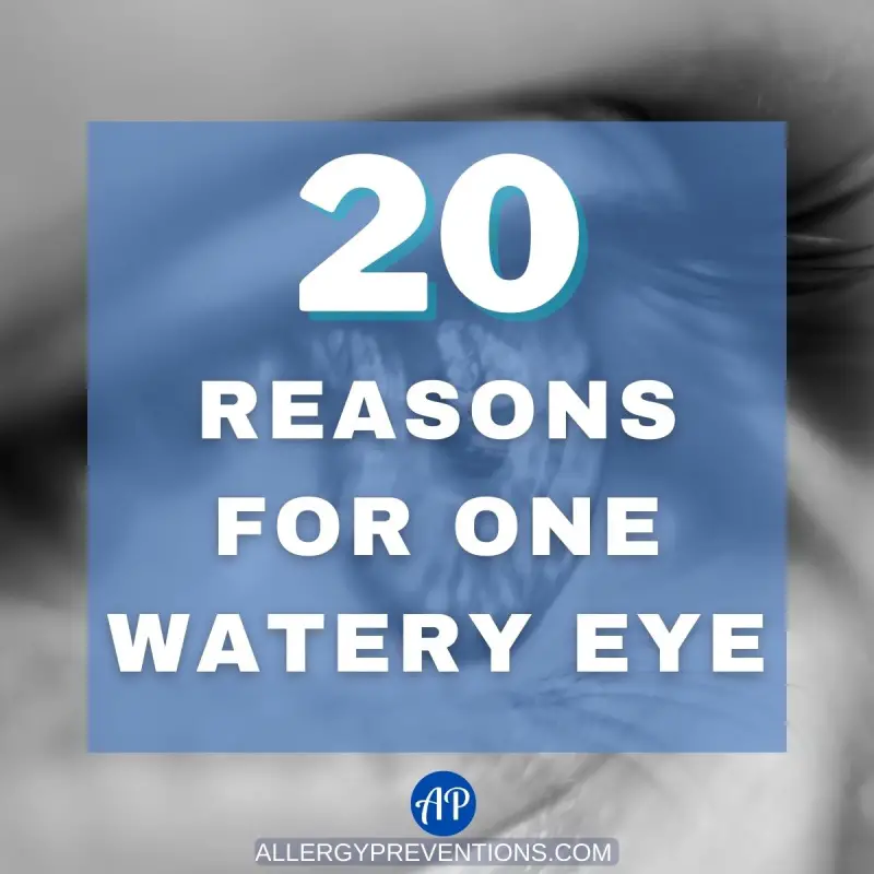 20 Reasons For One Watery Eye