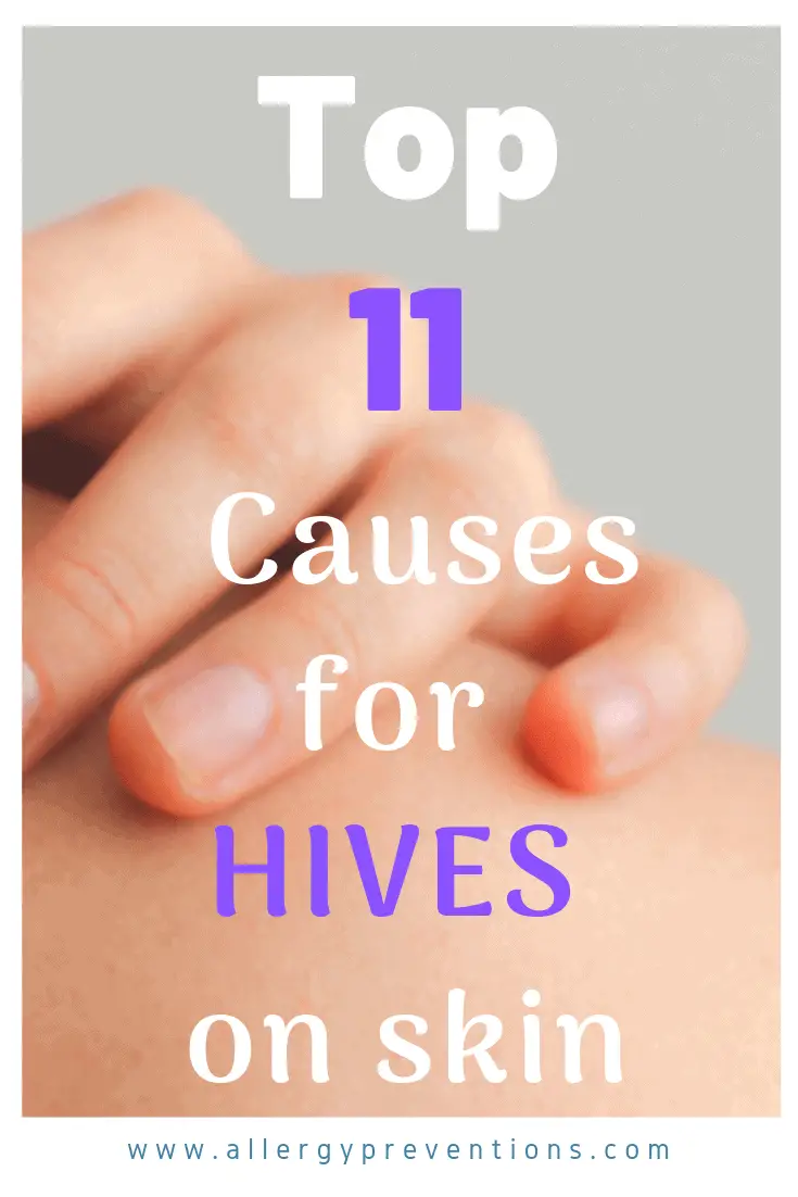 allergy-preventions-top-causes-hives-skin