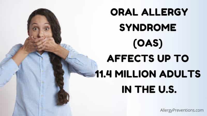 Oral Allergy Syndrome fact image states: Oral Syndrome (OAS) affects up to 11.4 million adults in the U.S. (United States), by allergypreventions.com 