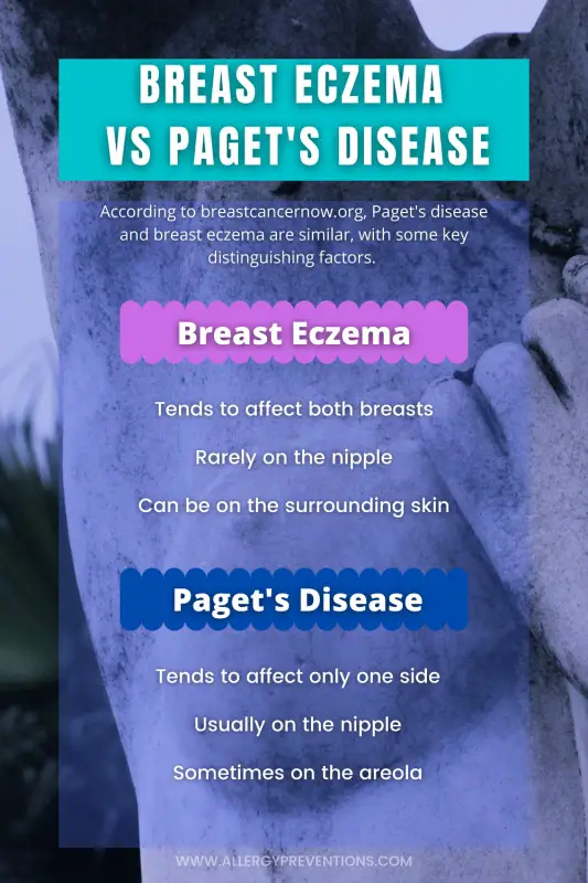 breast eczema versus paget's disease infographic. According to breastcancernow.org, Paget's disease and breast eczema are similar, with some key distinguishing factors. Breast eczema: Tends to affect both breasts, Rarely on the nipple, Can be on the surrounding skin. Paget's disease: ends to affect only one side, Usually on the nipple, Sometimes on the areola. designed by allergypreventions