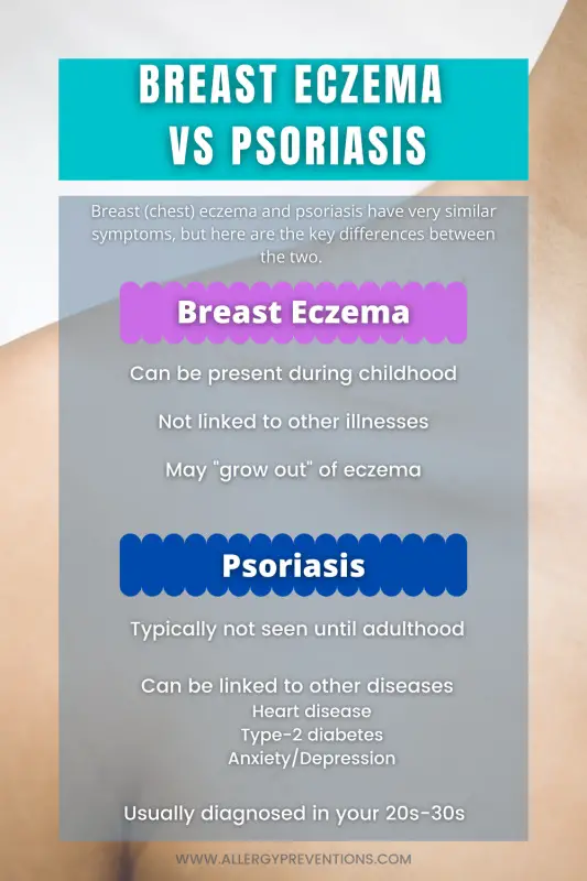 breast eczema versus psoriasis infographic. Breast (chest) eczema and psoriasis have very similar symptoms, but here are the key differences between the two. Breast eczema: Can be present during childhood, Not linked to other illnesses, May "grow out" of eczema. Psoriasis: Typically not seen until adulthood, Can be linked to other diseases (Heart disease, Type-2 diabetes, Anxiety/Depression), Usually diagnosed in your 20s to 30s 