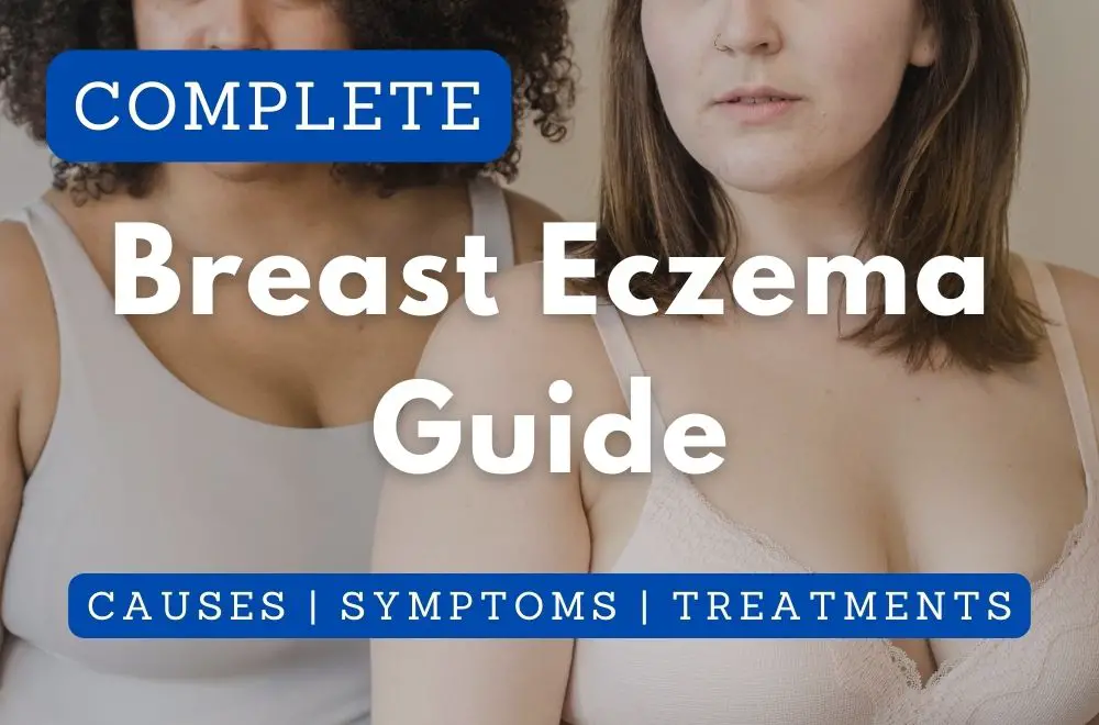 Complete Breast Eczema Guide: Causes, Symptoms, Treatments & More