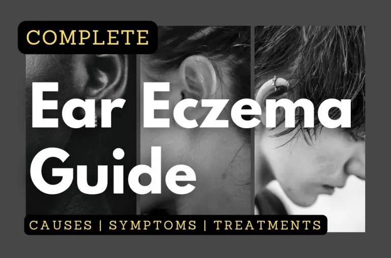 Complete Ear Eczema Guide Causes Symptoms Treatments And More