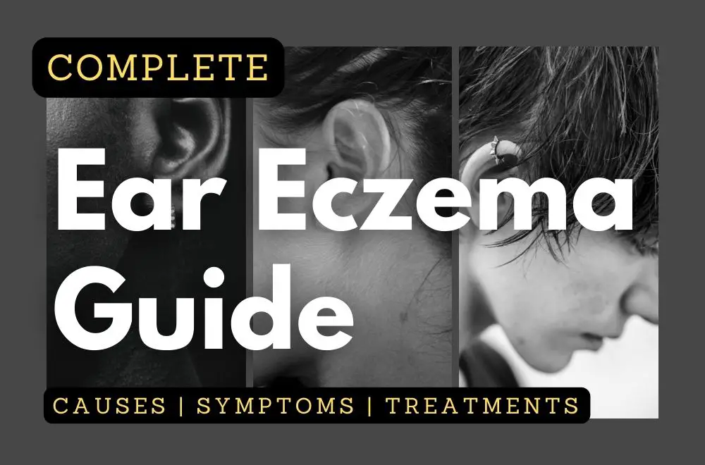 Complete Ear Eczema Guide: Causes, Symptoms, Treatments & More