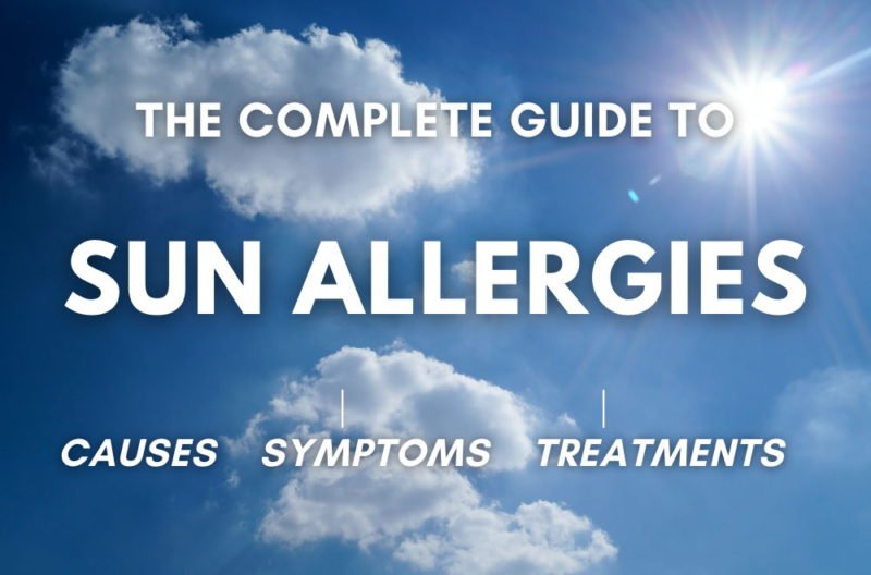 The Complete Guide to Sun Allergies - Allergy Preventions