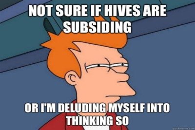 futurama character with shifty eyes with the caption: Not sure if hives are subsiding or i'm deluding myself into thinking so 