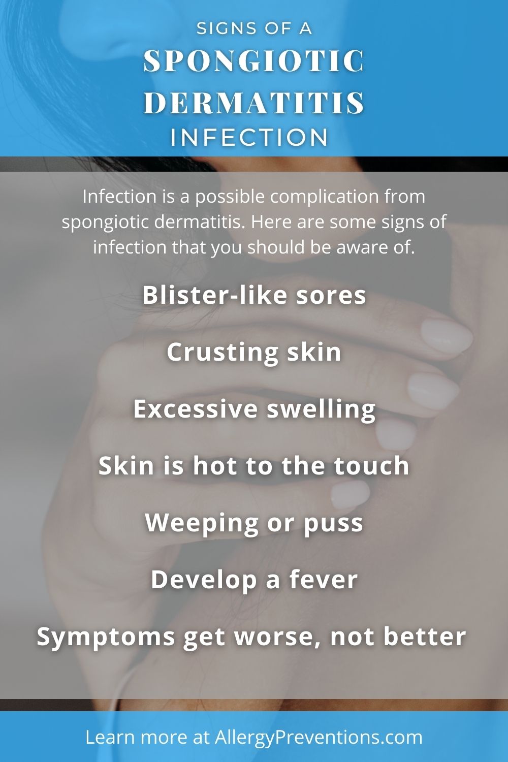 signs of a spongiotic dermatitis (SD) infection infographic. Signs and symptoms to be aware of. Blister-like sores
Crusting skin
Excessive swelling
Skin is hot to the touch
Weeping or puss
Develop a fever
Symptoms get worse, not better. allergypreventions.com 