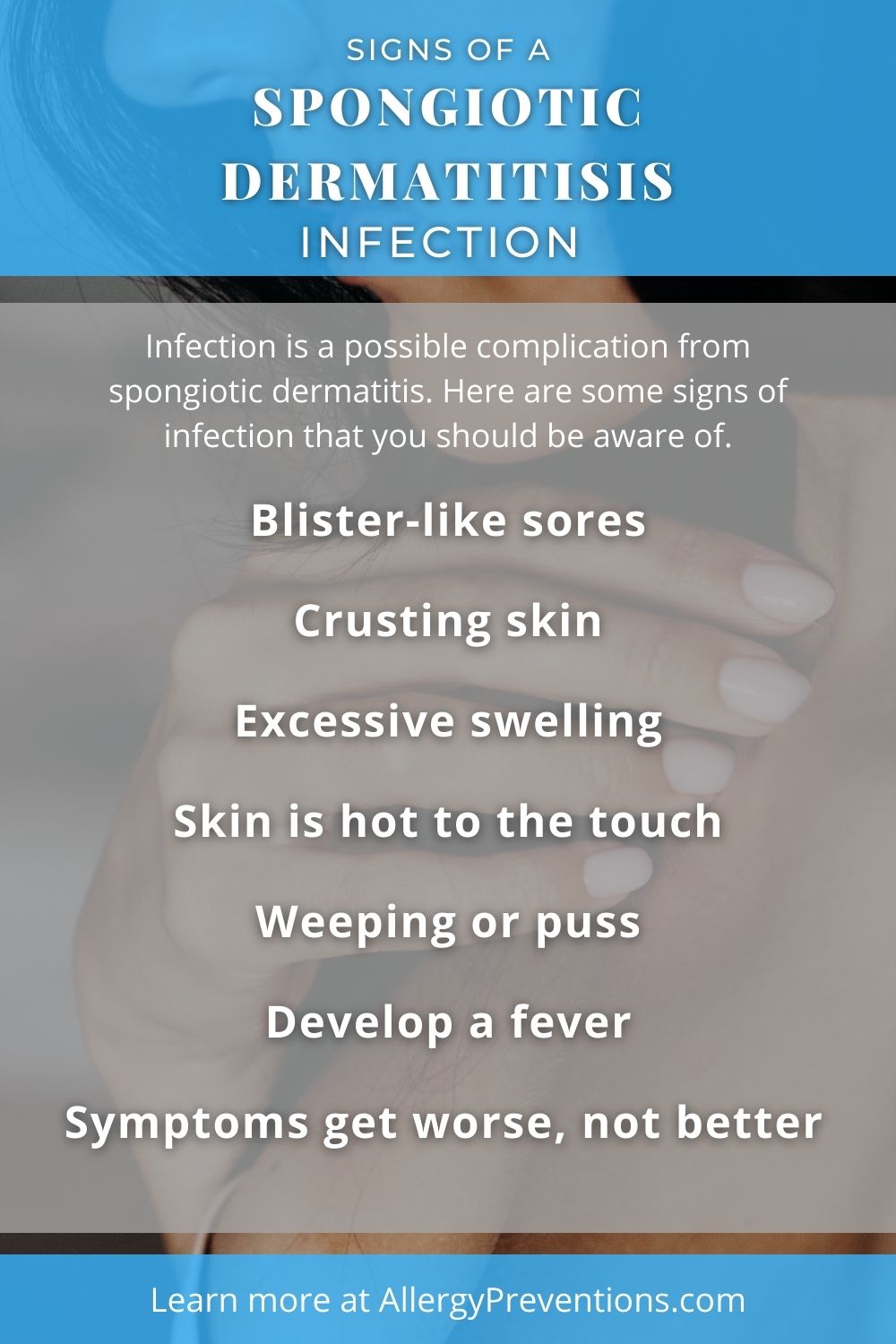 signs of a spongiotic dermatitis (SD) infection infographic. Signs and symptoms to be aware of. Blister-like sores Crusting skin Excessive swelling Skin is hot to the touch Weeping or puss Develop a fever Symptoms get worse, not better. allergypreventions.com