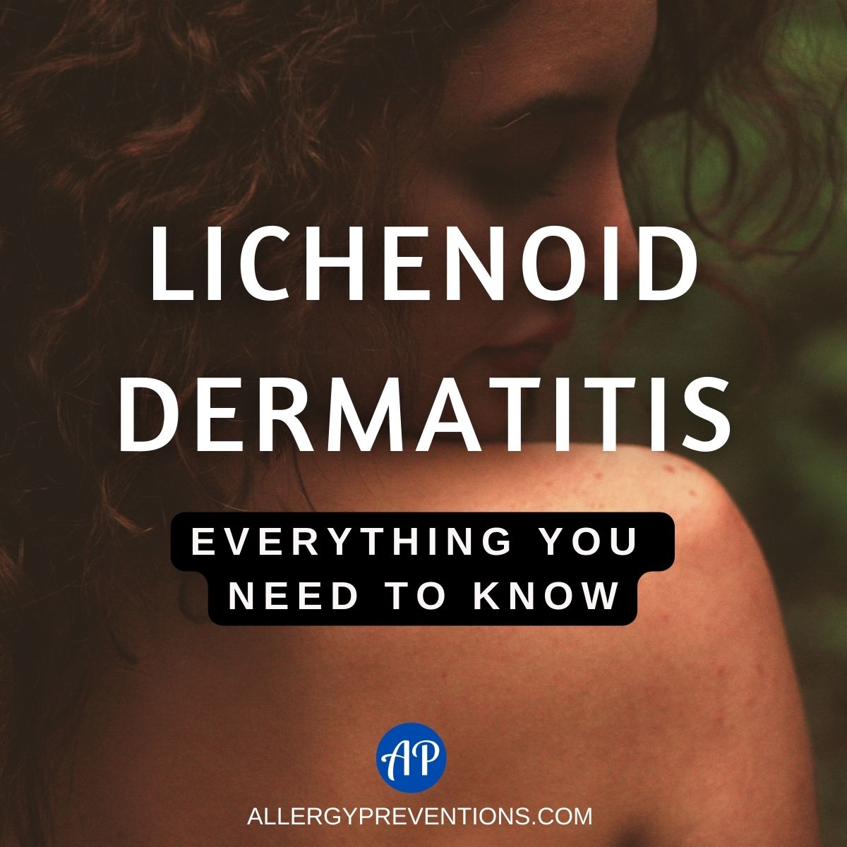 Lichenoid Dermatitis: Everything You Need To Know