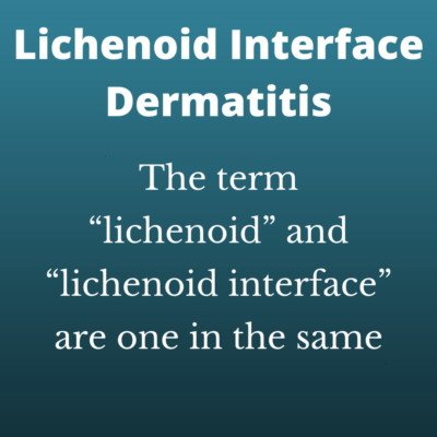 lichenoid interface dermatitis- the term "lichenoid" and lichenoid interface" are one in the same conditions