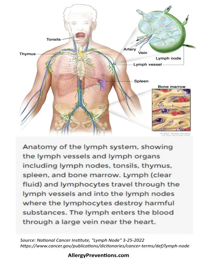 human torso infographic showing the anatomy of the lymph system with a picture of a lymph node that looks like a lima bean. lymph node definition: Anatomy of the lymph system, showing the lymph vessels and lymph organs including lymph nodes, tonsils, thymus, spleen, and bone marrow. Lymph (clear fluid) and lymphocytes travel through the lymph vessels and into the lymph nodes where the lymphocytes destroy harmful substances. The lymph enters the blood through a large vein near the heart. 