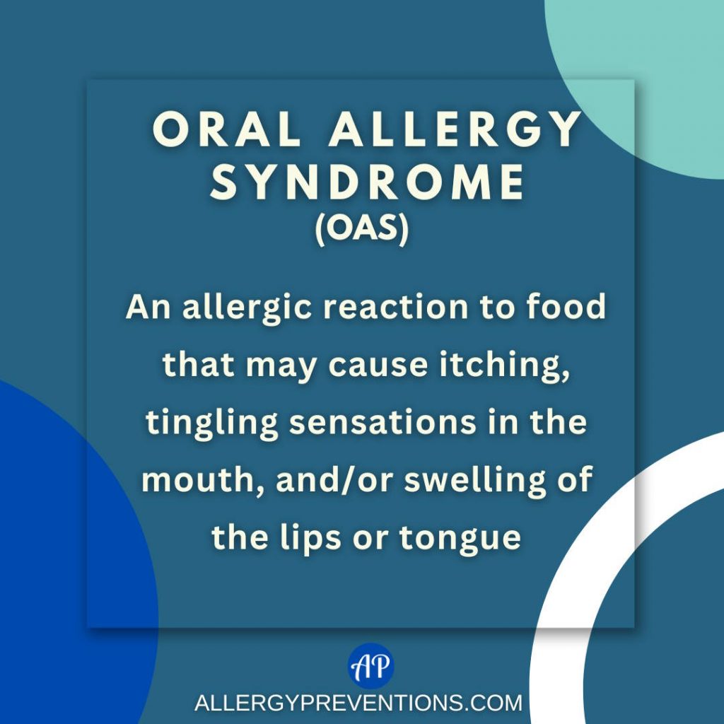 Oral allergy syndrome (OAS) infographic. OAS is an allergic reaction to food that may cause itching, tingling sensations in the mouth, and/or swelling of the lips or tongue.