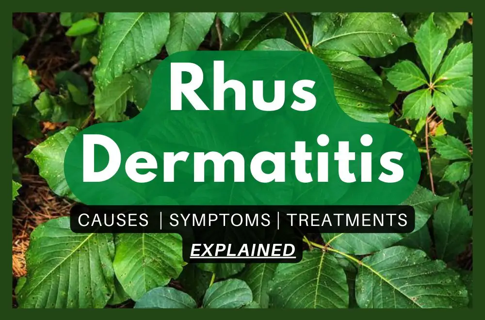 Rhus Dermatitis: Causes, Symptoms, and Treatments