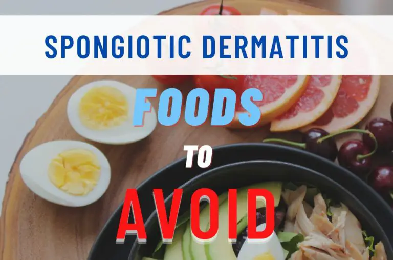 Spongiotic Dermatitis Foods To Avoid Allergy Preventions