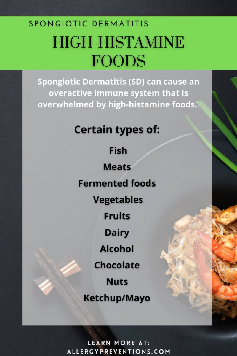 high histamine spongiotic dermatitis foods to avoid. Spongiotic Dermatitis Infographic of high-histamine foods. Spongiotic Dermatitis (SD) can cause an overactive immune system that is overwhelmed by high-histamine foods. Certain types of Fish, meats, fermented foods, vegetables, fruits, dairy, alcohol, chocolate, nuts, ketchup, and mayo