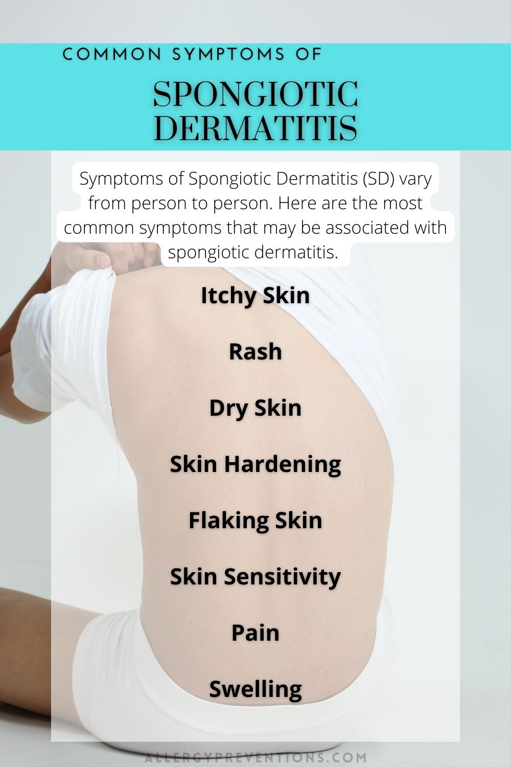 Common symptoms of Spongiotic Dermatitis infographic. Man holding up the back of his shirt with the following information.  Symptoms of Spongiotic Dermatitis (SD) vary from person to person. Here are the most common symptoms that may be associated with spongiotic dermatitis. Itchy Skin
Rash
Dry Skin
Skin Hardening
Flaking Skin
Skin Sensitivity
Pain
Swelling