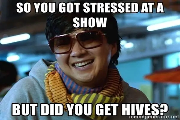 Chow from the movie "The Hangover" known for the quote "But did you die" with a caption: So you got stressed at a show, but did you get hives? 