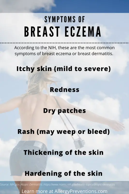 symptoms of breast eczema infographic. According to the NIH, these are the most common symptoms of breast eczema or breast dermatitis. Itchy skin (mild to severe), Redness, Dry patches, Rash (may weep or bleed), Thickening of the skin, Hardening of the skin. Created by allergypreventions