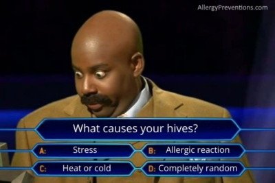 who wants to be a millionaire meme of a man with big eyes looking at the choices for the question. The question states: What causes your hives? The answer choices are A. Stress, B. Allergic reaction, C. Heat or Cold, D. Completely random 
